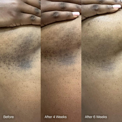 PRE-ORDER - Topicals  Faded Brightening & Cleansing Body Bar for Uneven Skin Tone (2 Pack)