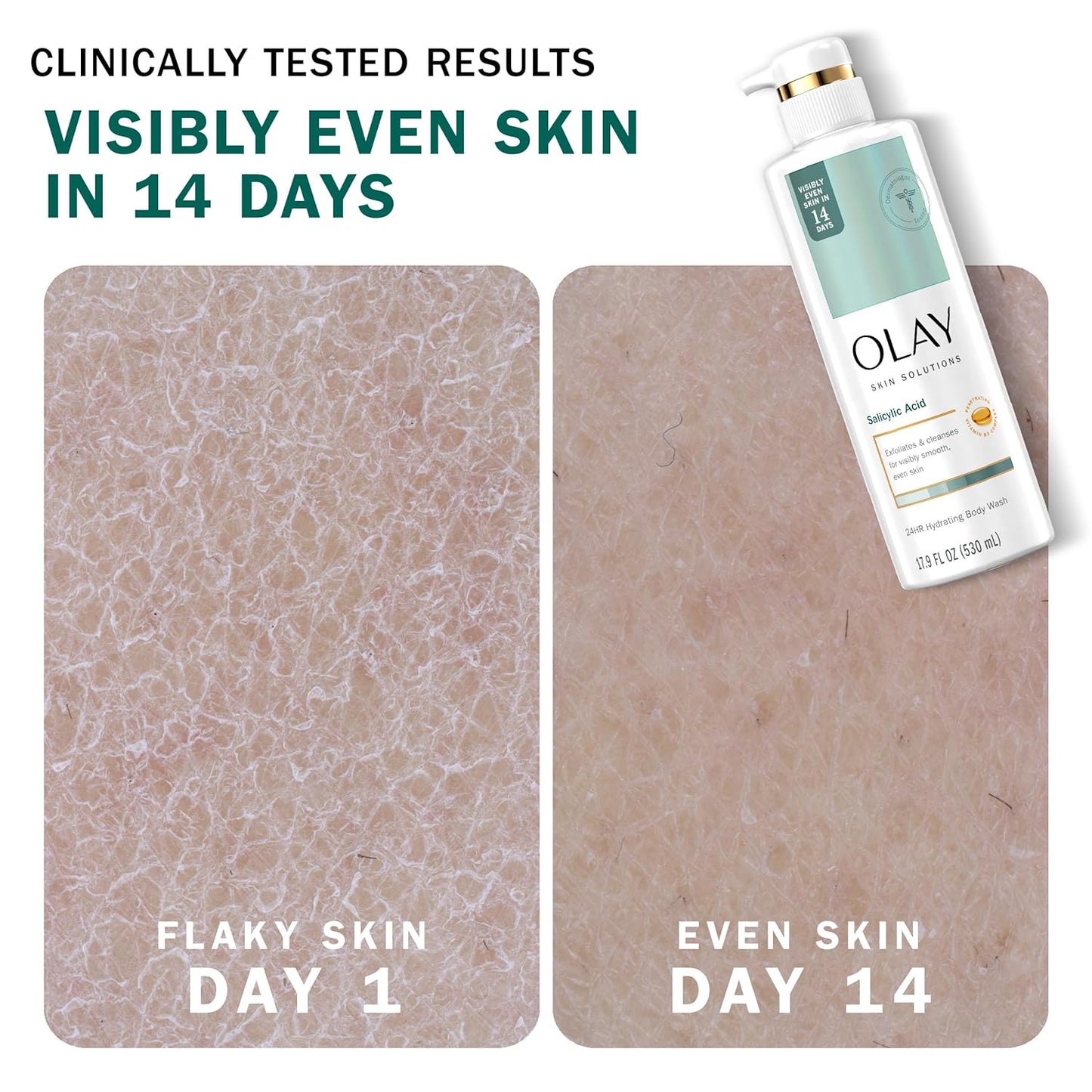 Olay Skin Solutions Hydrating Body Wash for Women with Salicylic Acid, 17.9 fl oz