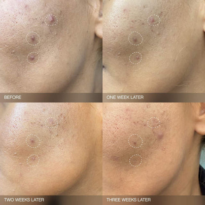 Topicals  Faded Brightening Bundle for Discoloration on Face & Body (UNSCENTED)